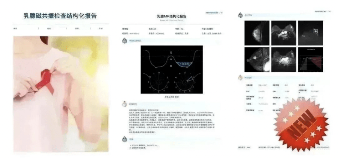 创新“打破”创新深睿医疗迎来全场景全流程AI数米乐M6 米乐智化新时代的先进生产力(图4)