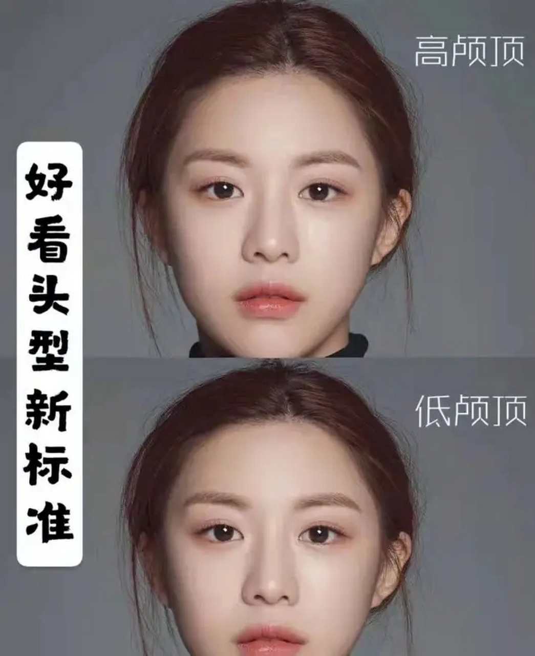 听我说洛神烟台洛神医疗美容医院高阶幼态脸米乐M6 米乐的关键是什么(图2)